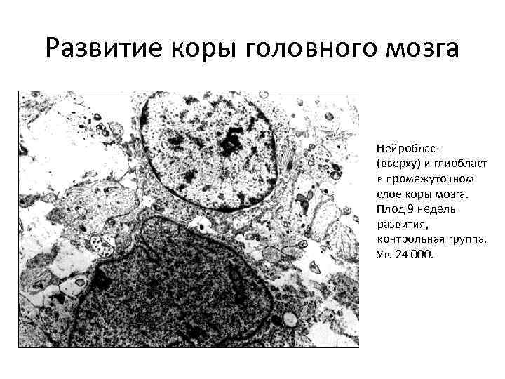 Развитие коры головного мозга Нейробласт (вверху) и глиобласт в промежуточном слое коры мозга. Плод