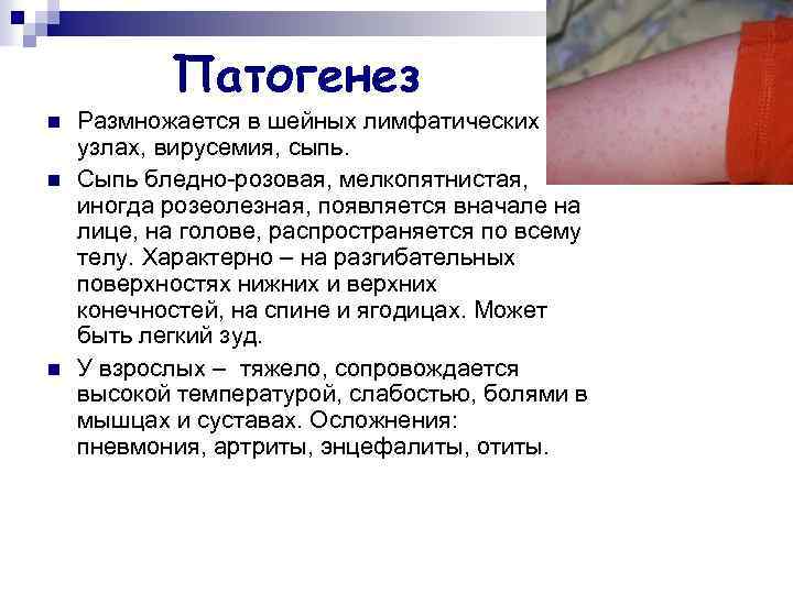 Патогенез n n n Размножается в шейных лимфатических узлах, вирусемия, сыпь. Сыпь бледно-розовая, мелкопятнистая,