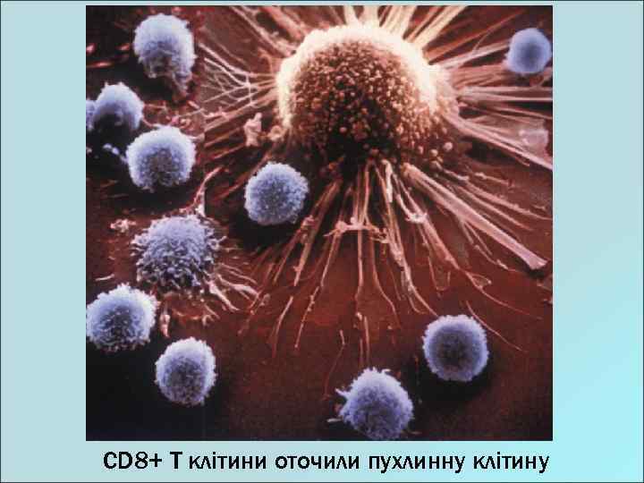 CD 8+ T клітини оточили пухлинну клітину 
