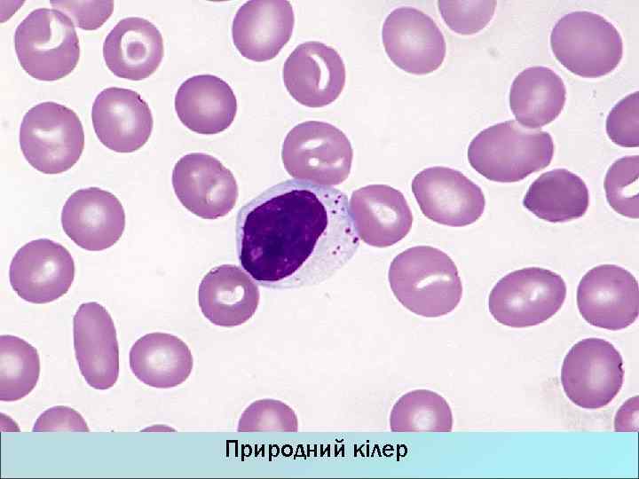 Природний кілер 