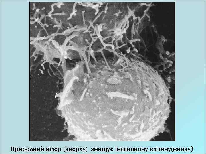 Природний кілер (зверху) знищує інфіковану клітину(внизу) 