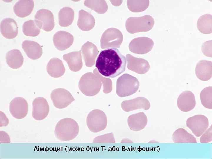 Лімфоцит (може бути Т- або В-лімфоцит!) 