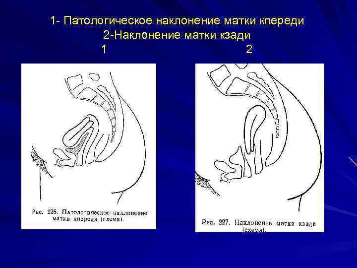 Матка кзади