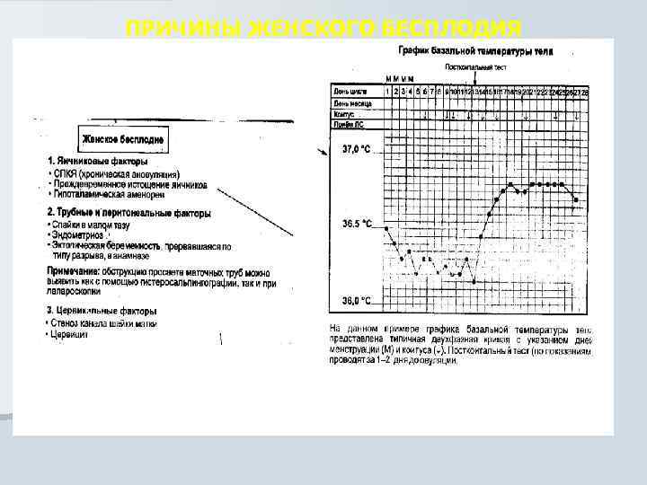 ПРИЧИНЫ ЖЕНСКОГО БЕСПЛОДИЯ 