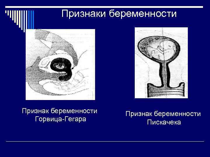 Признак горвица гегара при беременности