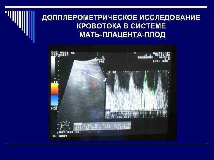 ДОППЛЕРОМЕТРИЧЕСКОЕ ИССЛЕДОВАНИЕ КРОВОТОКА В СИСТЕМЕ МАТЬ-ПЛАЦЕНТА-ПЛОД 