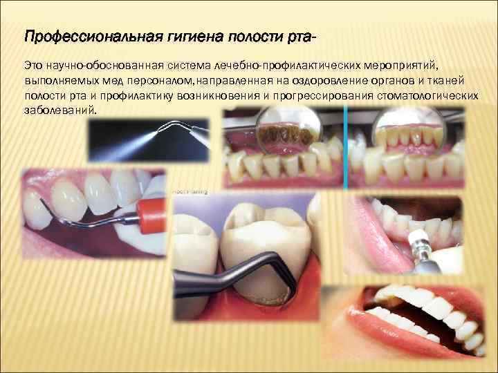 Стоматологические заболевания презентация