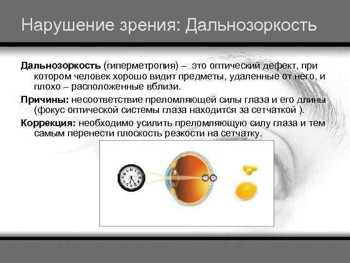 Нарушение зрения: Дальнозоркость (гиперметропия) – это оптический дефект, при котором человек хорошо видит предметы,