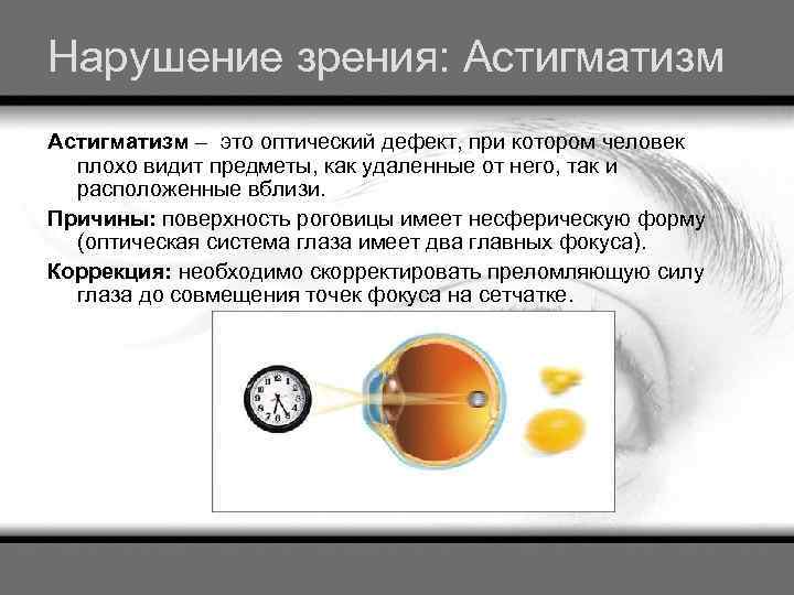 Нарушение зрения: Астигматизм – это оптический дефект, при котором человек плохо видит предметы, как