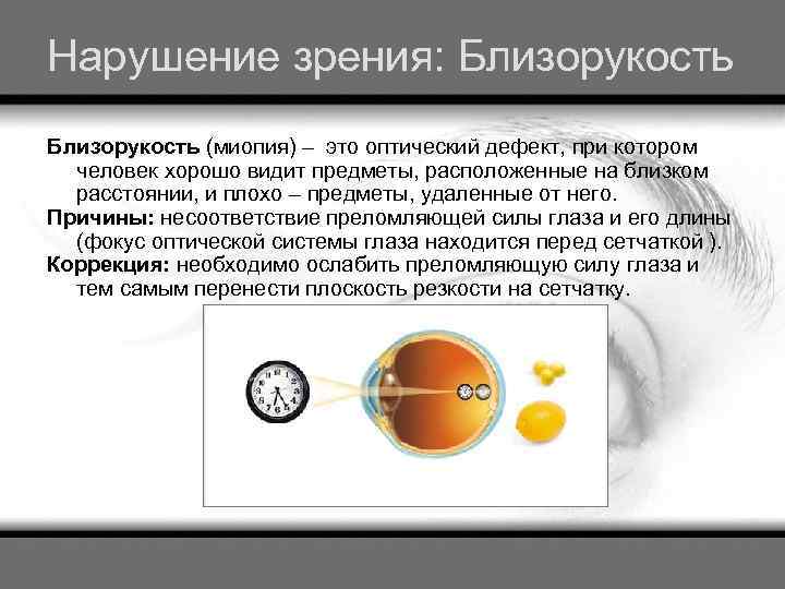 Нарушение зрения: Близорукость (миопия) – это оптический дефект, при котором человек хорошо видит предметы,