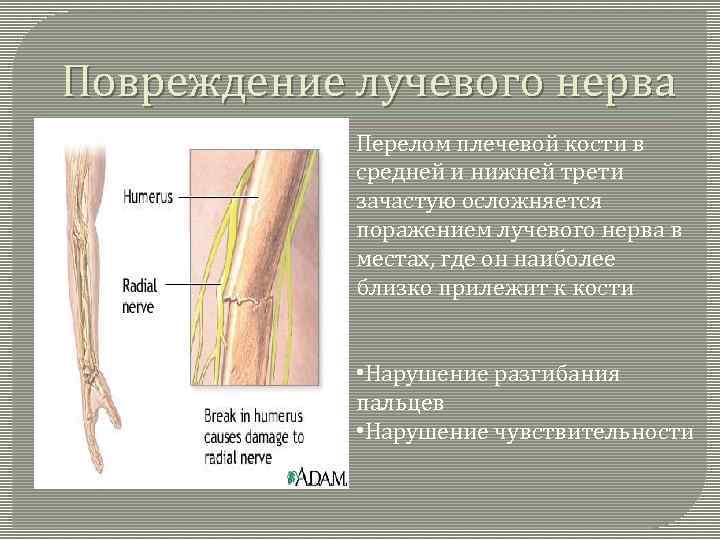 Повредили нерв после. Повреждение лучевого нерва при переломе лучевой кости. Симптомы повреждения лучевого нерва при переломах плеча. Повреждение глубокой ветви лучевого нерва. Повреждения лучевого нерва при переломе плеча.
