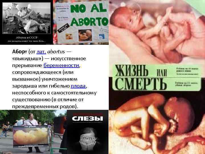 Аборт (от лат. abortus — «выкидыш» ) — искусственное прерывание беременности, сопровождающееся (или вызванное)