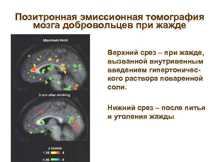Позитронная эмиссионная томография мозга добровольцев при жажде n n Верхний срез – при жажде,