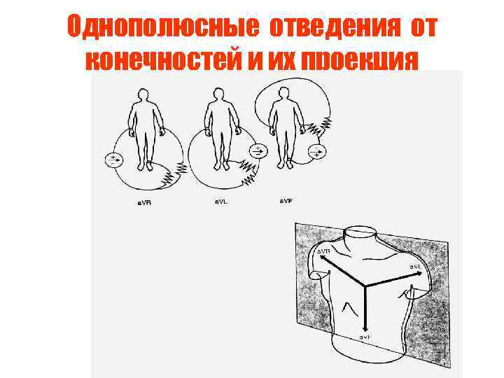 Однополюсные отведения от конечностей и их проекция 