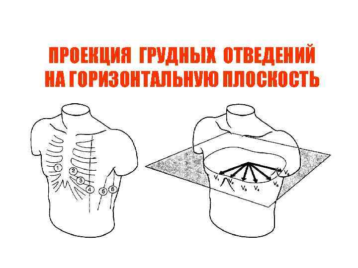 ПРОЕКЦИЯ ГРУДНЫХ ОТВЕДЕНИЙ НА ГОРИЗОНТАЛЬНУЮ ПЛОСКОСТЬ 