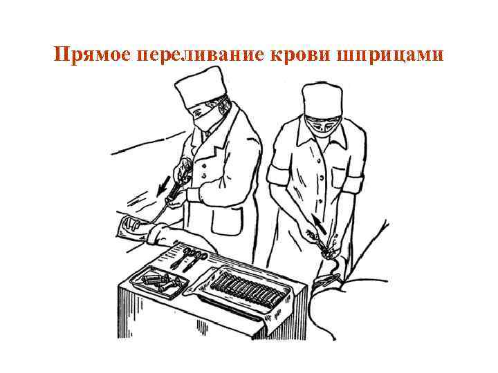 Прямое переливание крови шприцами 