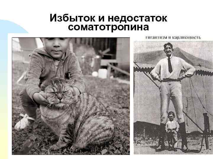 Избыток и недостаток соматотропина 