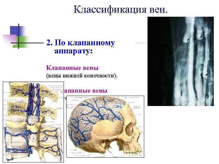 Классификация вен. 2. По клапанному аппарату: Клапанные вены (вены нижней конечности). Бесклапанные вены (вены