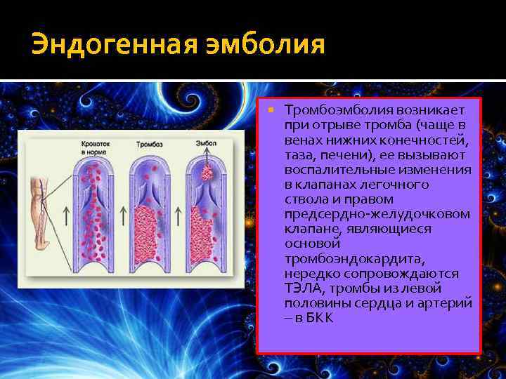 Эндогенная эмболия Тромбоэмболия возникает при отрыве тромба (чаще в венах нижних конечностей, таза, печени),