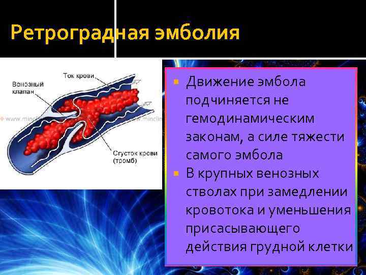 Признаки воздушной эмболии. Парадоксальная и ретроградная эмболия. Ретроградное движение эмбола. Ретроградная эмболия движение.