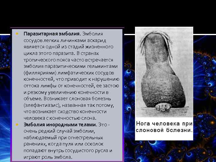 Паразитарная эмболия. Эмболия сосудов легких личинками аскарид является одной из стадий жизненного цикла этого