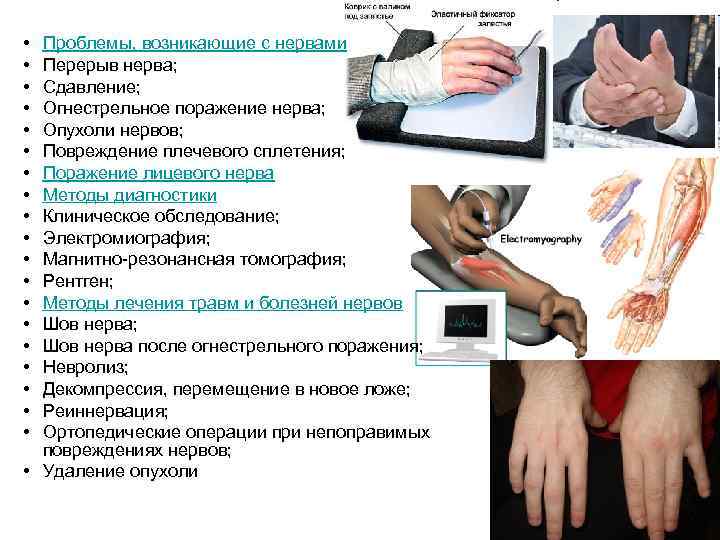  • • • • • Проблемы, возникающие с нервами Перерыв нерва; Сдавление; Огнестрельное