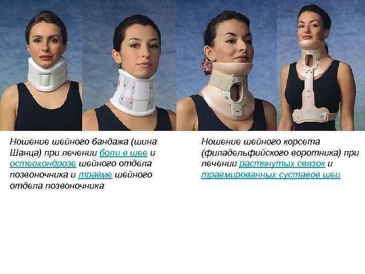 Ношение шейного бандажа (шина Шанца) при лечении боли в шее и остеохондрозе шейного отдела