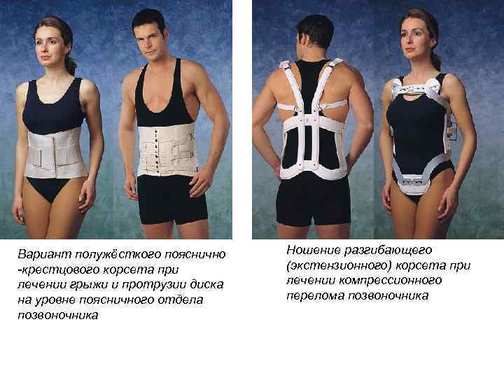 Вариант полужёсткого пояснично -крестцового корсета при лечении грыжи и протрузии диска на уровне поясничного