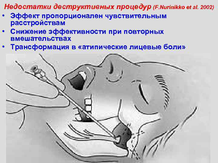 Недостатки деструктивных процедур (F. Nurinikko et al. 2002) • Эффект пропорционален чувствительным расстройствам •