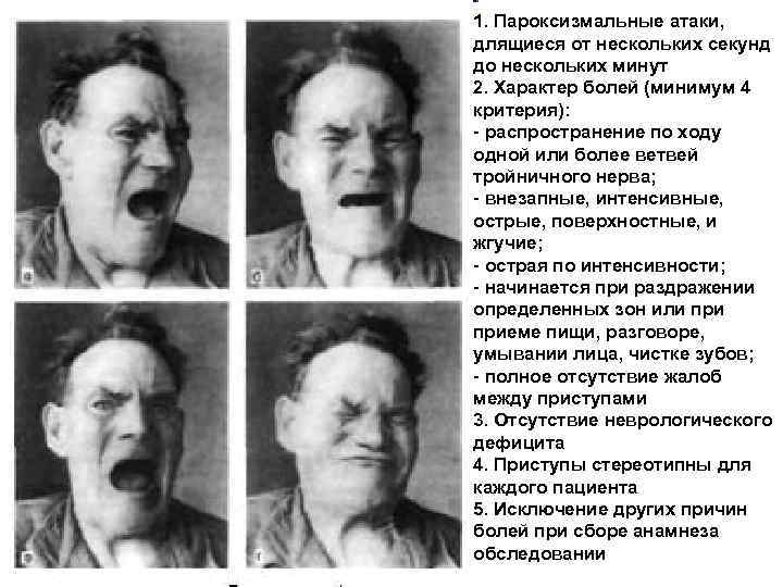 1. Пароксизмальные атаки, длящиеся от нескольких секунд до нескольких минут 2. Характер болей (минимум