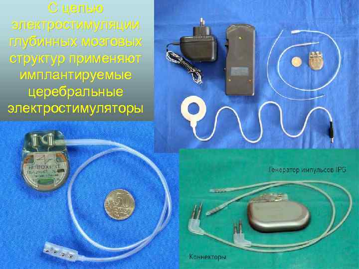 С целью электростимуляции глубинных мозговых структур применяют имплантируемые церебральные электростимуляторы 