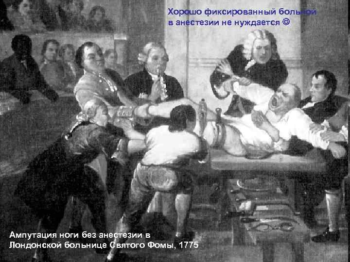 Хорошо фиксированный больной в анестезии не нуждается Ампутация ноги без анестезии в Лондонской больнице