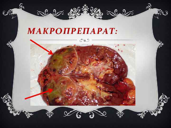 МАКРОПРЕПАРАТ: 