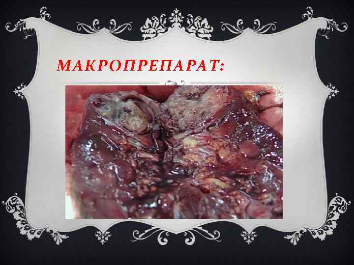 МАКРОПРЕПАРАТ: 