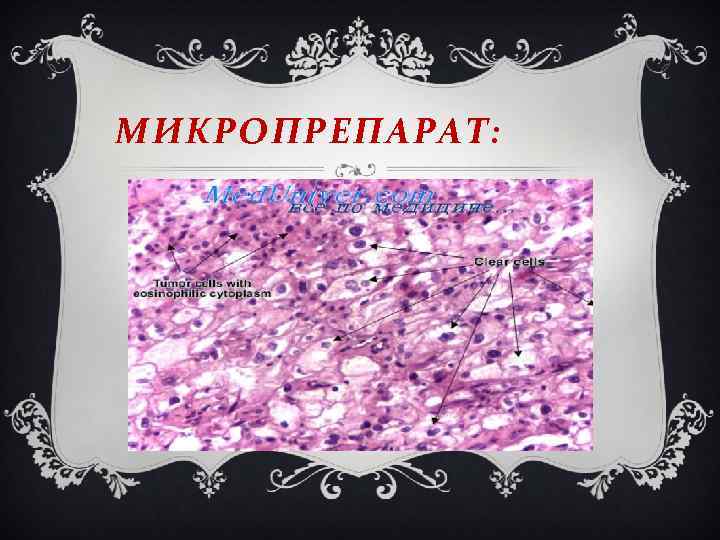 МИКРОПРЕПАРАТ: 