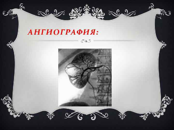 АНГИОГРАФИЯ: 