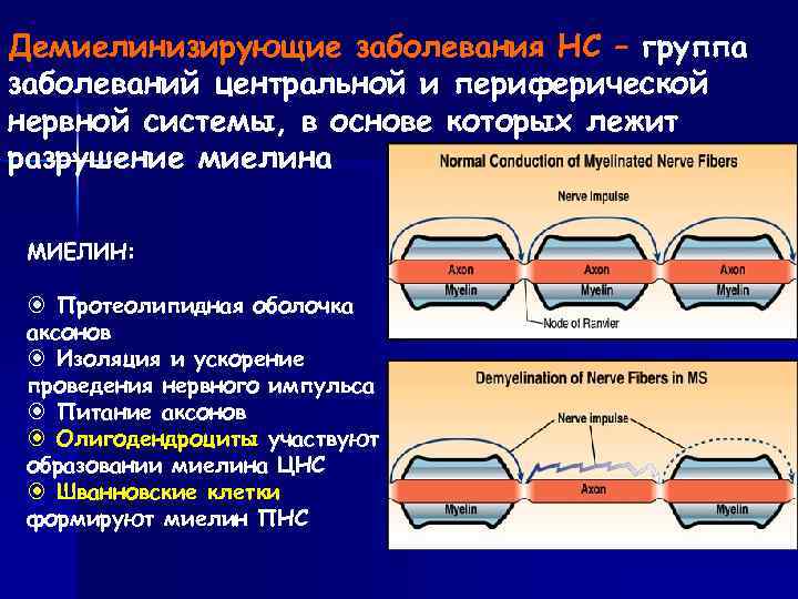 Демиелинизирующее заболевание. Функции миелина изоляция ускорение проведение импульса. Демиелинизирующее изменение большеберцовых нервов с двух сторон. Демиелинизирующий процесс при воспалении нерва. Какой из белков миелина ЦНС человека является наиболее иммуногенным.