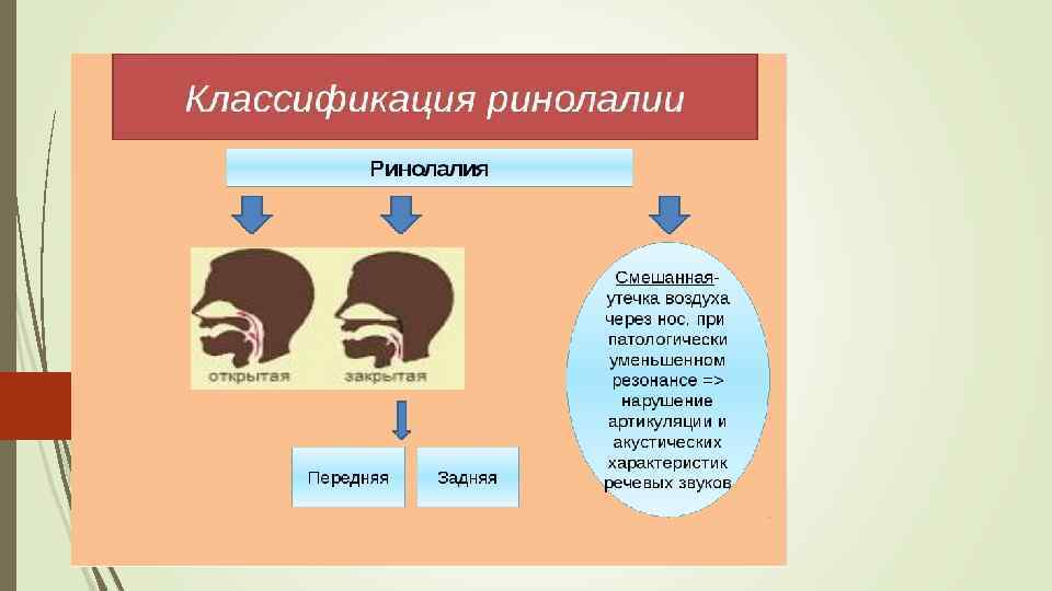 Ринолалия картинки для презентации