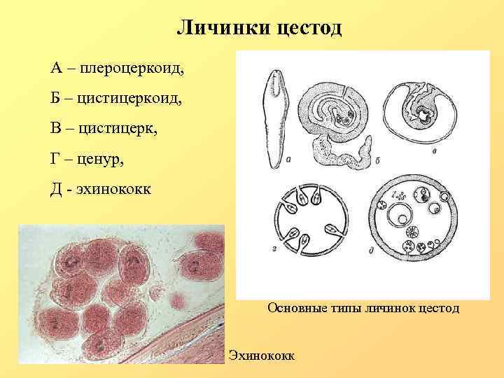 Личинки цестод А – плероцеркоид, Б – цистицеркоид, В – цистицерк, Г – ценур,