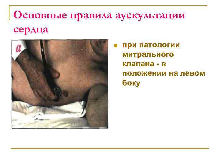 Основные правила аускультации сердца n при патологии митрального клапана в положении на левом боку