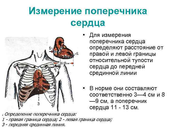 Измерение поперечника сердца • Для измерения поперечника сердца определяют расстояние от правой и левой