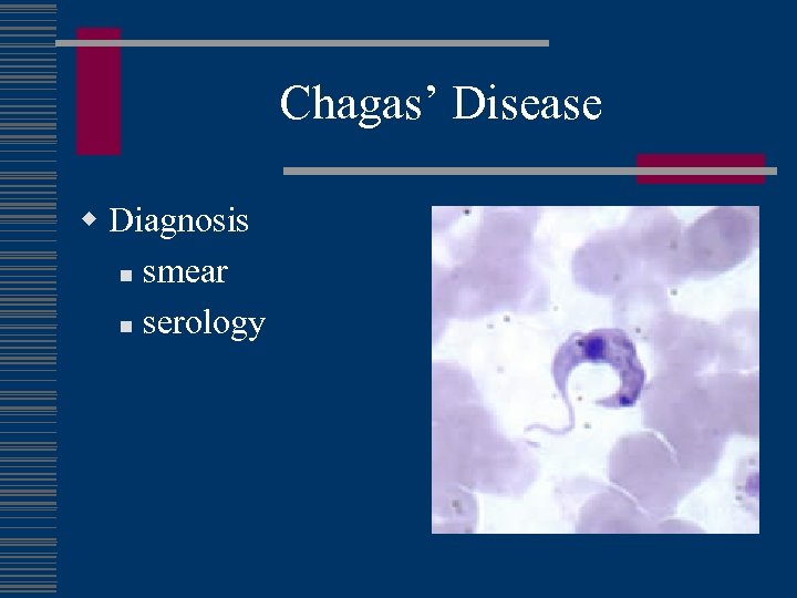 Chagas’ Disease w Diagnosis n smear n serology 