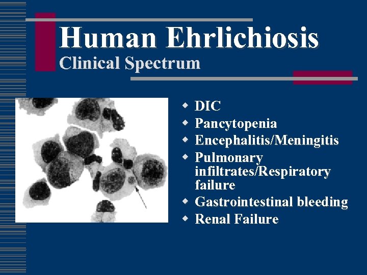 Human Ehrlichiosis Clinical Spectrum w w DIC Pancytopenia Encephalitis/Meningitis Pulmonary infiltrates/Respiratory failure w Gastrointestinal