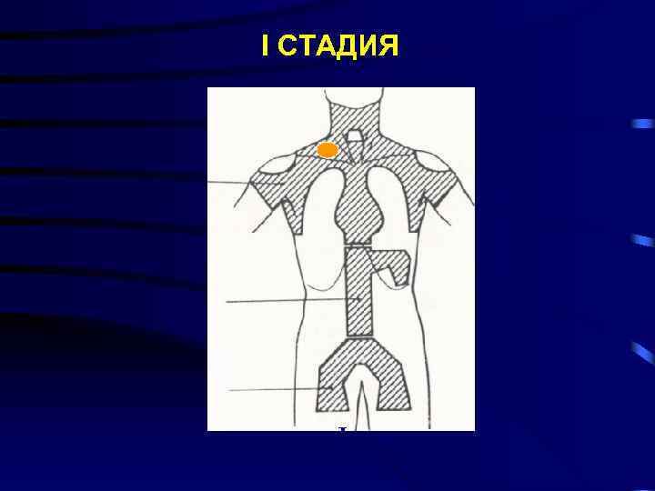 I СТАДИЯ С у б т о т а л ь н о е