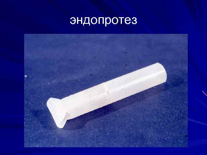 эндопротез 