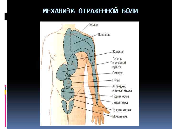 МЕХАНИЗМ ОТРАЖЕННОЙ БОЛИ 
