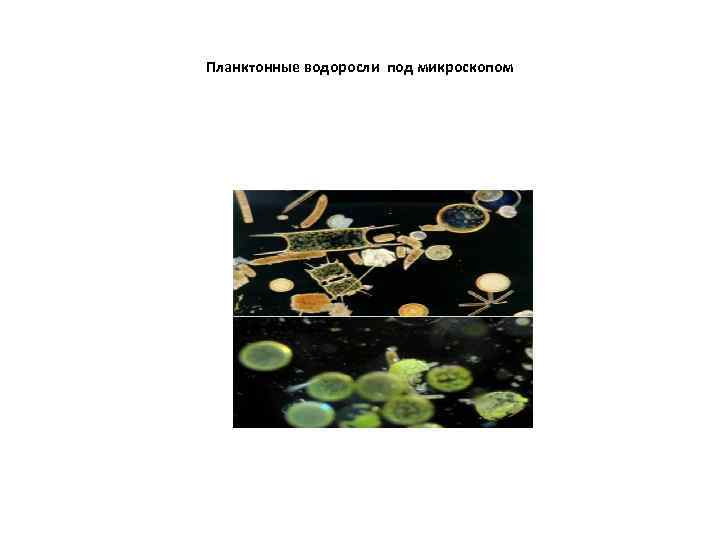 Планктонные водоросли под микроскопом 