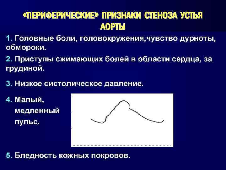  «ПЕРИФЕРИЧЕСКИЕ» ПРИЗНАКИ СТЕНОЗА УСТЬЯ АОРТЫ 