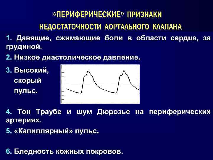  «ПЕРИФЕРИЧЕСКИЕ» ПРИЗНАКИ НЕДОСТАТОЧНОСТИ АОРТАЛЬНОГО КЛАПАНА 