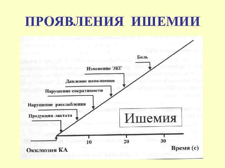 ПРОЯВЛЕНИЯ ИШЕМИИ 